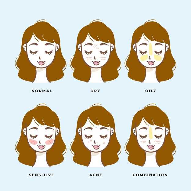 Clopidogrel skin reactions