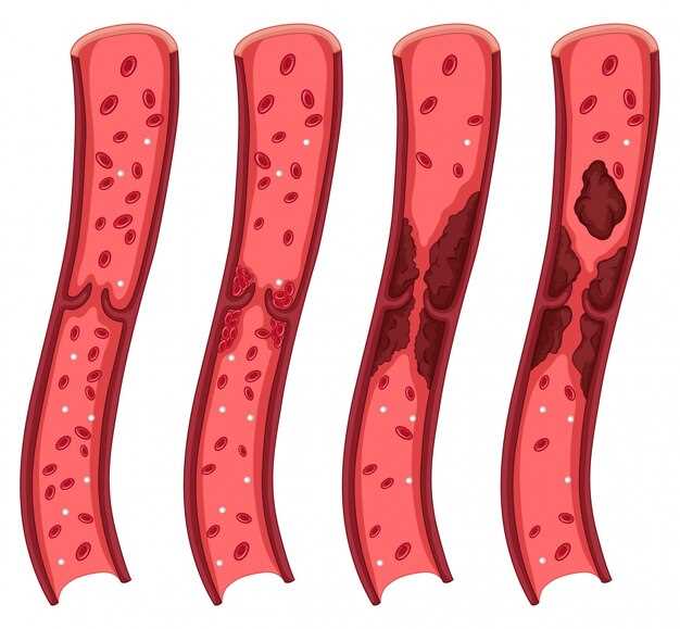 Enhanced Arterial Support