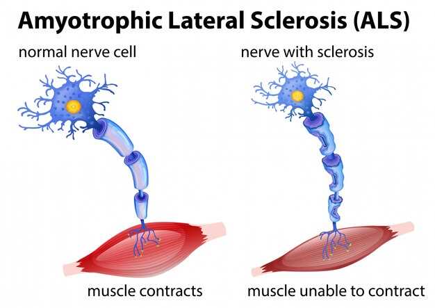 Peripheral nerve block clopidogrel